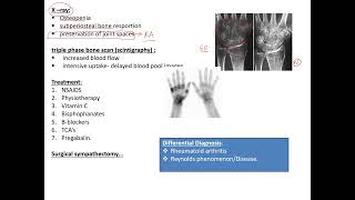 Dr Jalal Orthopedics made easySudecks dystrophy [upl. by Hsu]