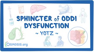 Sphincter of Oddi dysfunction Year of the Zebra 2024 [upl. by Eenafets]