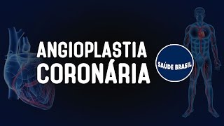 ANGIOPLASTIA CORONÁRIA  SÉRIE SAÚDE BRASIL [upl. by Petunia]