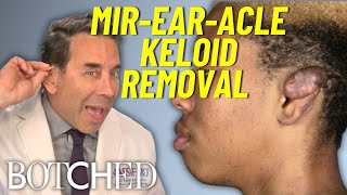 Dr Nassif Removes GIANT Keloid From Andre’s Ear  Botched  E [upl. by Intruoc]