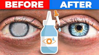 The 1 Remedy for Cataracts [upl. by Felicidad]