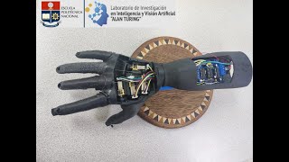 Myoelectric Prosthesis Control with Deep Learning [upl. by Noreh194]