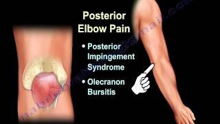 ELBOW PAIN  COMMON CAUSES  Everything You Need To Know  Dr Nabil Ebraheim [upl. by Monte]