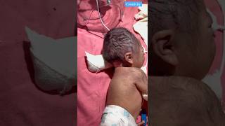 Long Time At Birth Cannel newbornbaby viralvideo [upl. by Aitas]