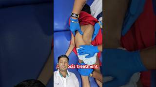 Chiropractic treatment for scoliosis physiotherapy chiropractor baby love backpaintreatment [upl. by Winston]