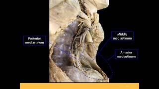 Mediastinum PPT Slide Presentation [upl. by Padraic170]