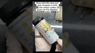 urine analysis How to do urine microscopic and physical examination urinetest urineanalysis [upl. by Wyatt938]