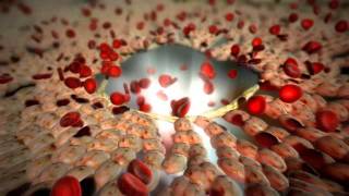 Medical Animation  Hepatic [upl. by Ycram124]