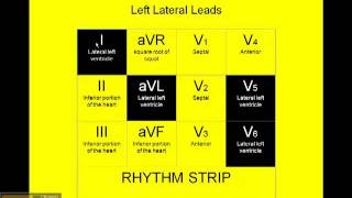 1215 Lead ECG What the Leads See [upl. by Dor]