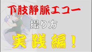 【下肢静脈エコー】検査の進め方と観察のポイント！ [upl. by Ardekahs]