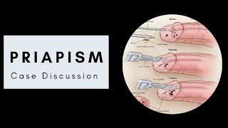 Case Discussion  Priapism [upl. by Iruahs428]