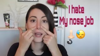 Nose job regrets  one month after rhinoplasty [upl. by Stevenson]