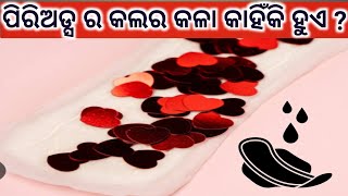 ପିରିଅଡ୍ସ ର କଲର କଳା କାହିଁକି ହୁଏ। Periods Colour Meaning। Black Blood During Periods। Odia Health Tips [upl. by Neerihs313]