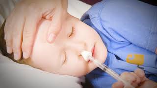 How to Give Your Child Nasal Midazolam [upl. by Messab]