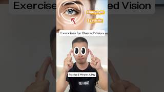 Exercises for Blurred Visioneyecare eyecareawareness eyehealth eyehealthy blurredvision [upl. by Aleunamme]