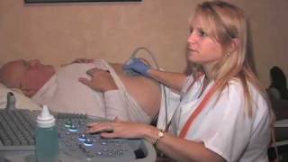 AAA Ultrasound Screening [upl. by Aloap]