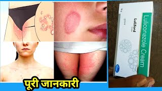 LULIFORD CREAM USES IN HINDI LULICONAZOLE CREAM USES SIDE EFFECTS IN HINDI [upl. by Chrisoula554]