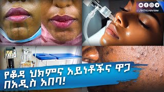 የቆዳ ህክምና አይነቶችና ዋጋ በአዲስ አበባ Dermatology Clinic in Addis Ababa Ethiopia [upl. by Kluge353]