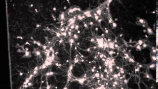 Calcium imaging in neuronal culture [upl. by Rapp555]