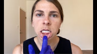 Tongue and Lip Ties  Myofunctional Therapy SelfAssessment [upl. by Haneehs]