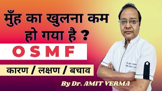 OSMF ORAL FIBROSIS हिंदी में  causes symptoms and treatment full explanation by dr amit verma [upl. by Eigroeg]