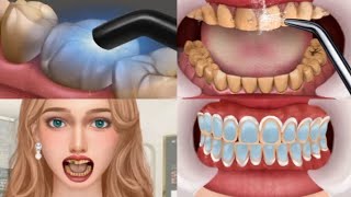 ASMR Mouth Cleaning  Get rid of bad breath  tonsil stones removal salivary glands cleaning [upl. by Knowland703]