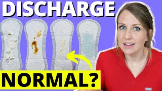 Doctor Answers Top 5 Discharge Questions [upl. by Wrdna643]