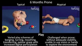 6 Month Old Baby Typical amp Atypical Development Side by Side [upl. by Anihsak]