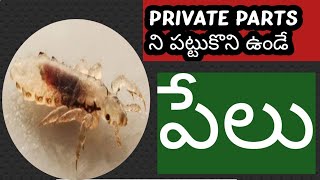 pubic lice చాలా చిరాకు పుట్టించేవి ఇవి జననాంగాల దగ్గర ఉంటాయి 😔😔 [upl. by Htiduy]