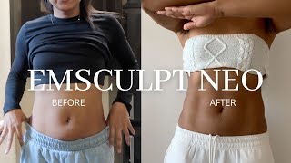 Emsculpt Neo  Before amp After Honest Opinion [upl. by Edwin]