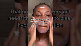 How to fade hyperpigmentation FAST [upl. by Mercedes846]