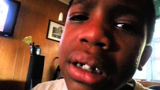 Crying Five Year Olds Super Loose Tooth [upl. by Clemen]