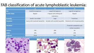 Precursor Lymphoid Neoplasms [upl. by Nosnirb]