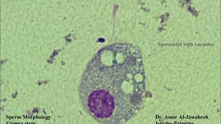 Sperm morphologyRound cells [upl. by Airetak]