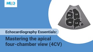 Echocardiography Essentials Mastering the apical fourchamber view 4CV [upl. by Assyle87]