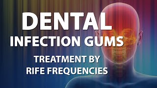 Dental Infection Gums  RIFE Frequencies Treatment  Energy amp Quantum Medicine with Bioresonance [upl. by Dunn943]