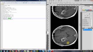 Dr Eye  Export DICOM dataset to a MetaImage Raw file [upl. by Gnil161]