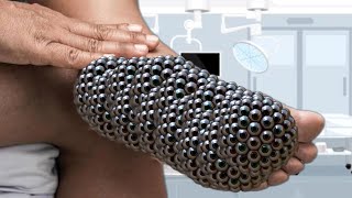 Asmr video 📸 😴 aamr aniMost Desirable Trypophobia satisfying Larva cleaning Belly [upl. by Caryl]