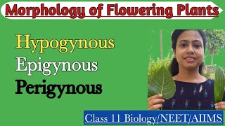 Types of flowers Hypogynous  Epigynous PerigynousMorphology of Flowering PlantsClass 11 Biology [upl. by Koch]