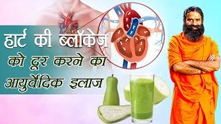 Ayurvedic Treatment for Heart Blockage  Swami Ramdev [upl. by Anahcar475]