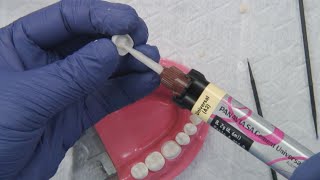 Zirconia 101 9 of 11 Preparation and cementing protocols [upl. by Arst]