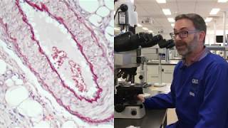 Microscope tutorial  Troubleshooting elastin stains  Part 2 [upl. by Hardunn]