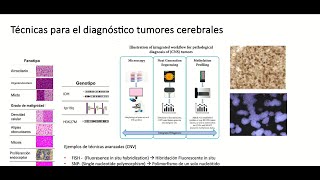 Simposio Multidisciplinario Contra los Gliomas Cerebrales [upl. by Ennobe123]