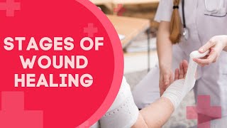 The Stages of Wound Healing [upl. by Lishe]