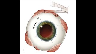 ANATOMY OF EXTRAOCULAR MUSCLES COMMON TENDINOUS RINGNERVE SUPPLYACTIONCLINICAL IMPORTANCE [upl. by Gusta242]