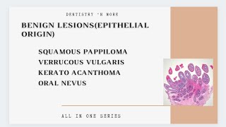 BENIGN LESIONS TUMORS EPITHELIAL ORIGIN [upl. by Amelita]