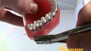 How to Use the Distal End Cutter Powerprox Six Month Braces Orthodontic Education Video [upl. by Animrelliug]