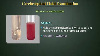 Cerebrospinal Fluid Examination CSF [upl. by Beal]