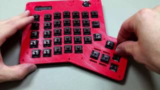 How to Build an Ergodox Assembly 9 [upl. by Demakis]