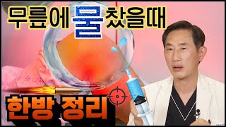 무릎에 물 차는 원인  무릎에 물 빼야 할까 말아야 할까  무릎에서 물 말고 00나오면 큰일 납니다feat임병은 원장 [upl. by Carlin59]